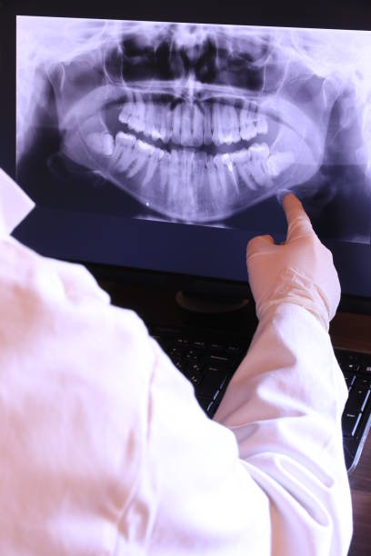 Best Emergency Root Canal Treatment in Rothschild, WI