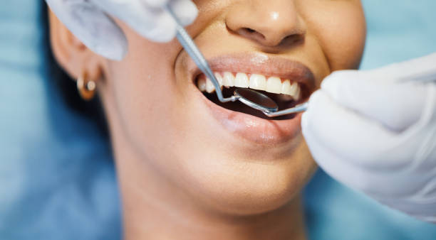 Best Urgent Care for Lost Fillings or Crowns in Rothschild, WI